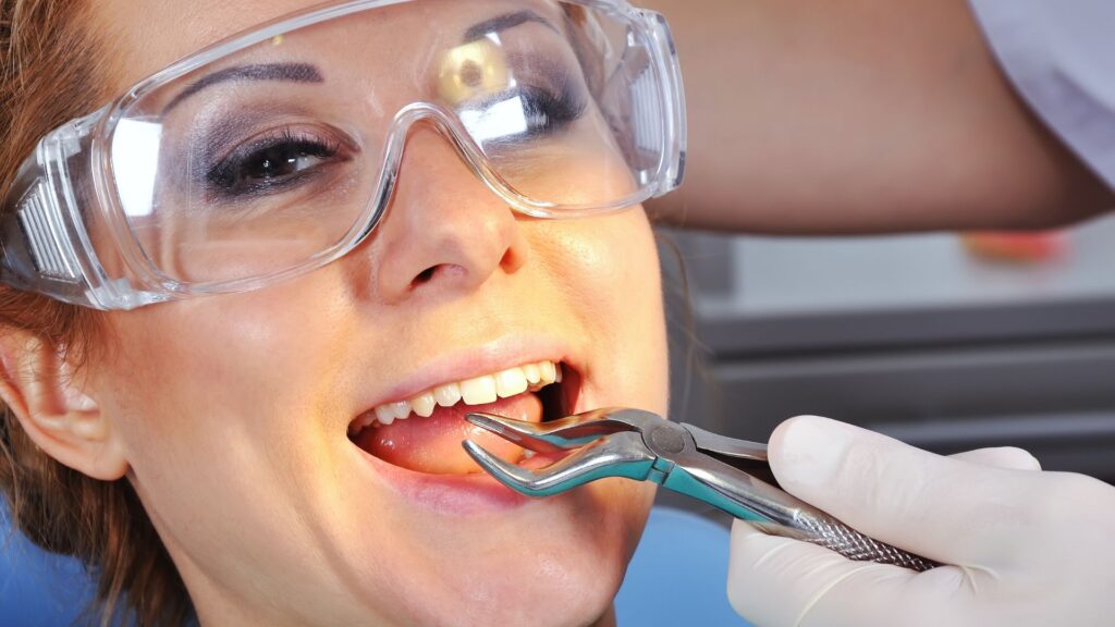 Affordable Options for Tooth Extractions in Kennewick and Richland