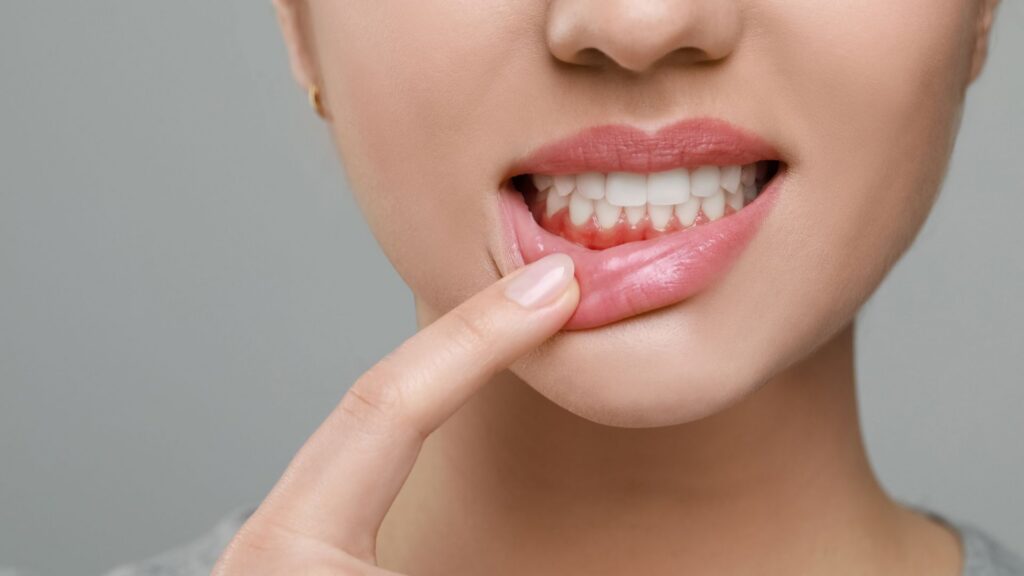 How Do Dentists Diagnose Gum Disease Near Kennewick and Richland