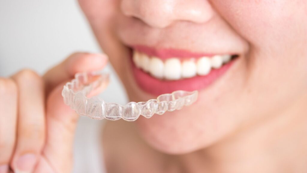 Questions to Ask During Your Invisalign Consultation in Kennewick and Richland