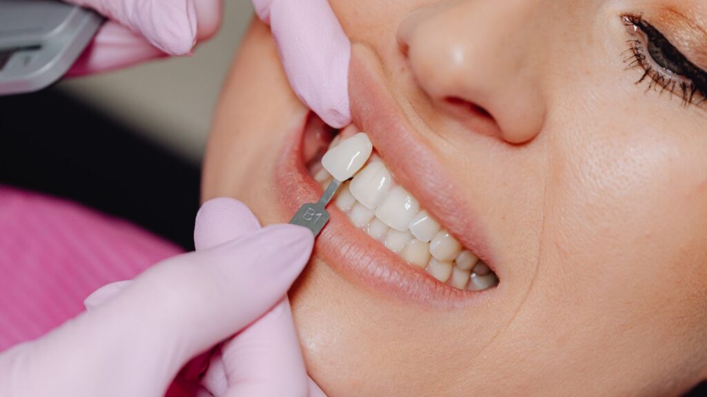 What Tooth Replacement Options Restore Missing Teeth