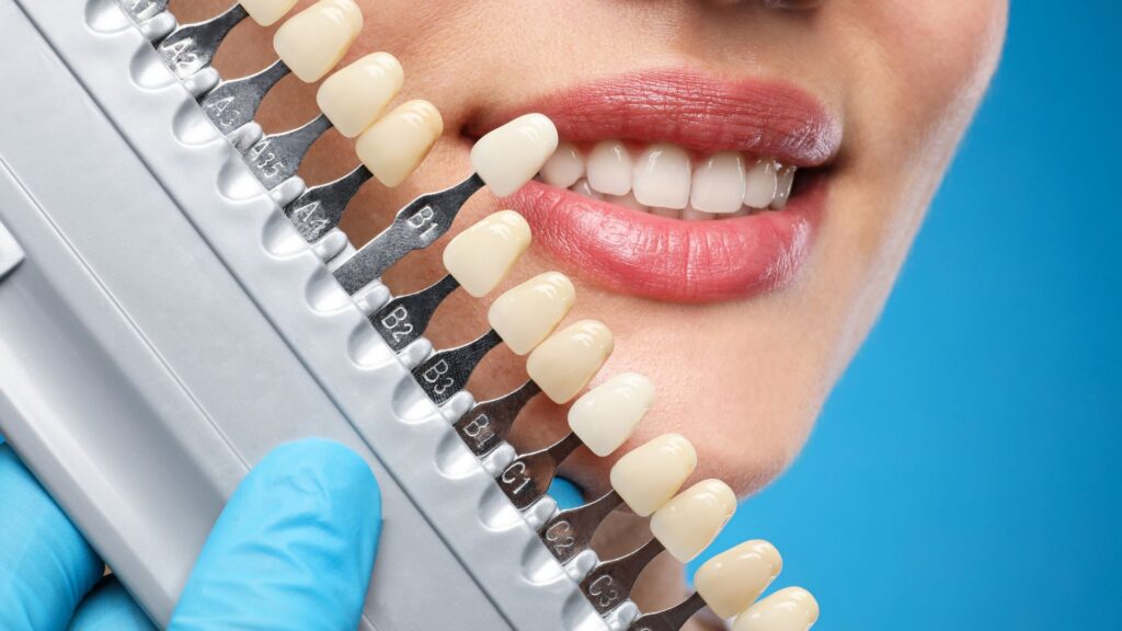Common Cosmetic Dentistry Services That Can Improve Smile Confidence