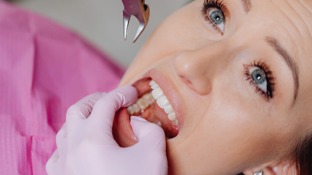 When Tooth Extractions in Kennewick and Richland May Become the Right Next Step