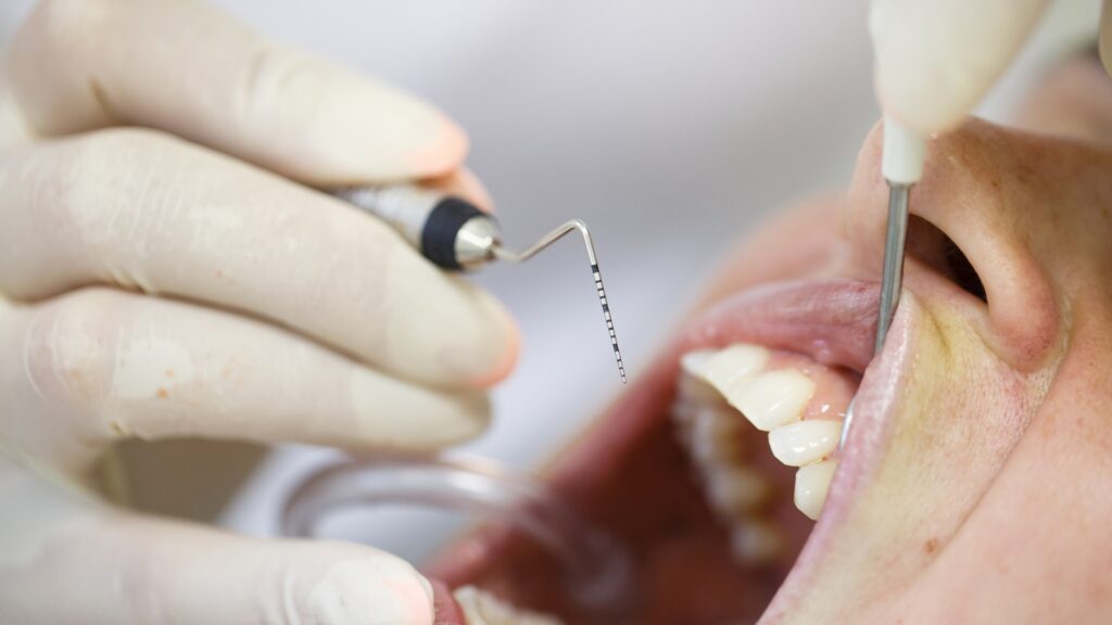 Why Periodontal Treatment in Kennewick and Richland Supports Healthy Teeth and Gums